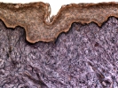 Elastic fibers in human skin section (Verhoeff stain)