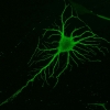 Neuronal precursor differentiated from a human mesenchymal stem cell
