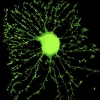 Human stem cells differentiated into mature neurons neurofilaments