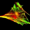 Vimentin and actin filaments in a human fibroblast in culture