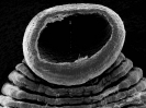 Anterior sucker part of an Europen medical leech (Hirudo medicinalis)