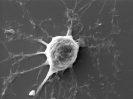 A human stem cell differentiated into a neuron-like cells in vitro