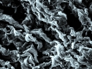 Collagen fibers in a human loose connective tissue