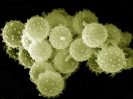 Pollens of powder mushroom (Lycoperdon sp.)