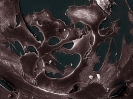 Human umbilical cord stroma multipotent stroma cells